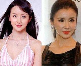 娱乐圈整容成风,美丽背后的代价与反思